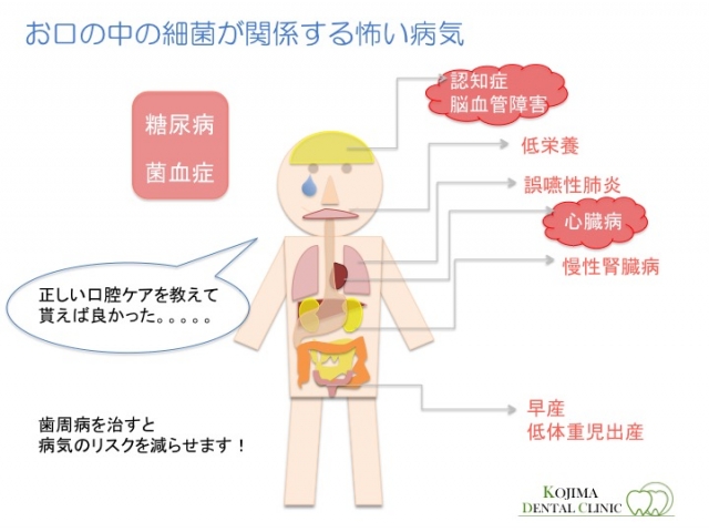 口腔と全身疾患